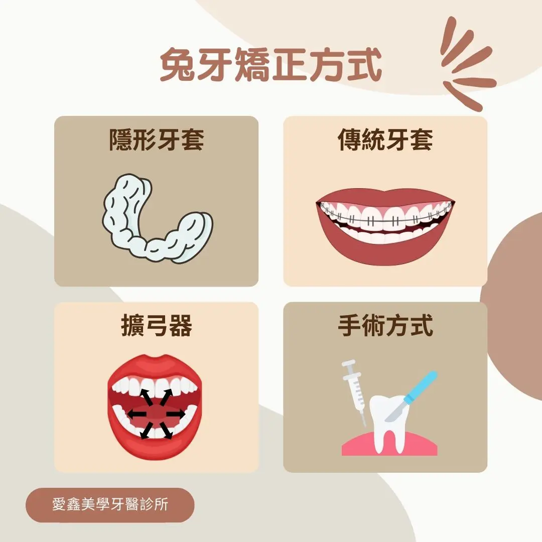 兔牙矯正方式有隱形矯正、傳統牙套、擴弓器、手術等