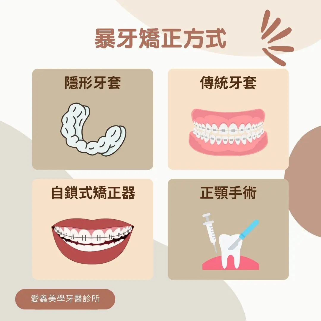 暴牙矯正主要有4種，分別是隱形牙套、傳統矯正、自鎖式矯正器及正顎手術